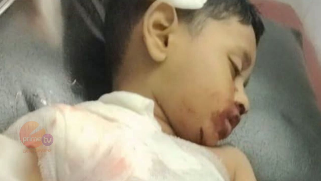 সাতকানিয়ায়  সড়ক দুর্ঘটনায় বাঁশখালীর ৭ বছর বয়সী আফসান নিহত,আহত পিতামাতা। 