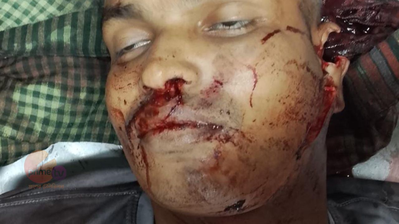 সাতকানিয়ায় রাতের মোটরসাইকেল আরোহীকে কুপিয়ে হত্যা।