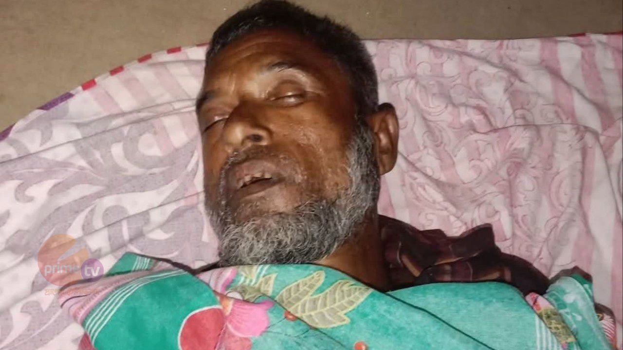 জামালপুরে সাপেড় কামড়ে ১ জনের মৃত্যু